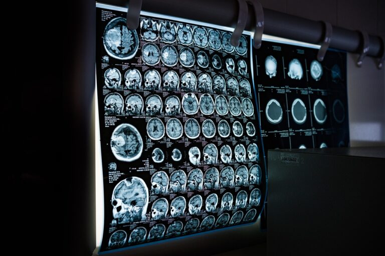 Wie KI in der Radiologie die Bildbefundung unterstützt Wie KI in der Radiologie die Bildbefundung unterstützt