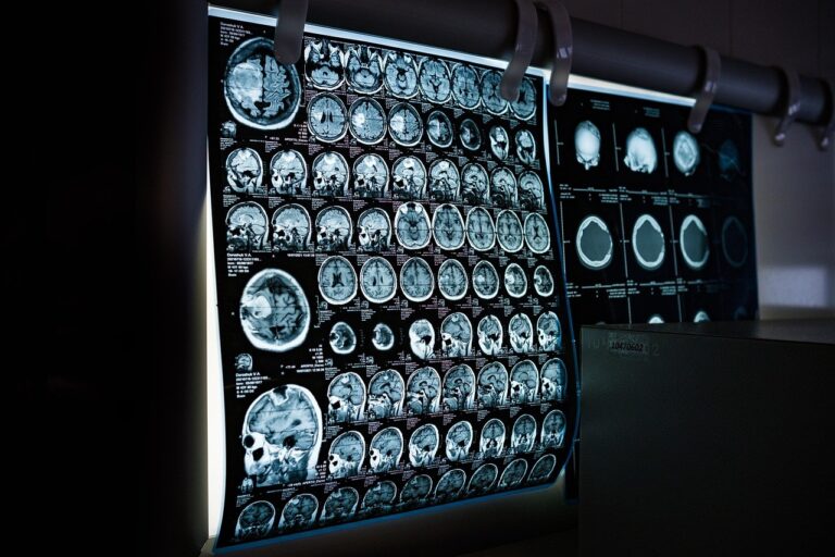 Erster epileptischer Anfall: Sicher helfen, den Ablauf dokumentieren und die Diagnose klären