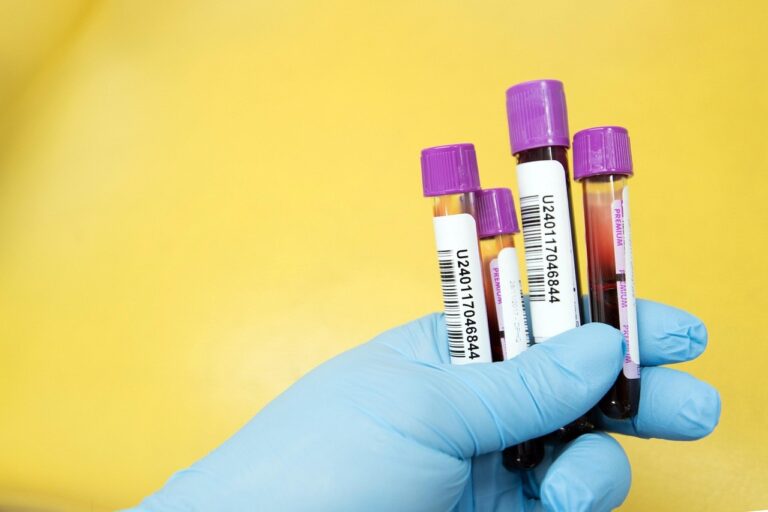 Vitamin-B12-Mangel abklären: Warum Beschwerden, Ernährung und Aufnahme zusammen geprüft werden